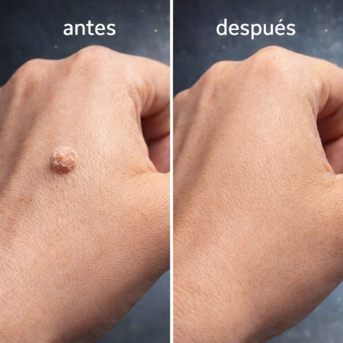 AHCC®-ELIMINADOR DE VERRUGAS CAUSADAS POR EL VPH (60 cápsulas). DISTRIBUIDOR OFICIAL®.